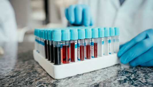 Lab Accreditation & DUI In Denver